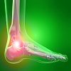 Drawing of Pain in Foot Ankle (Cliparts) ankle,foot,pain,bone,clipart